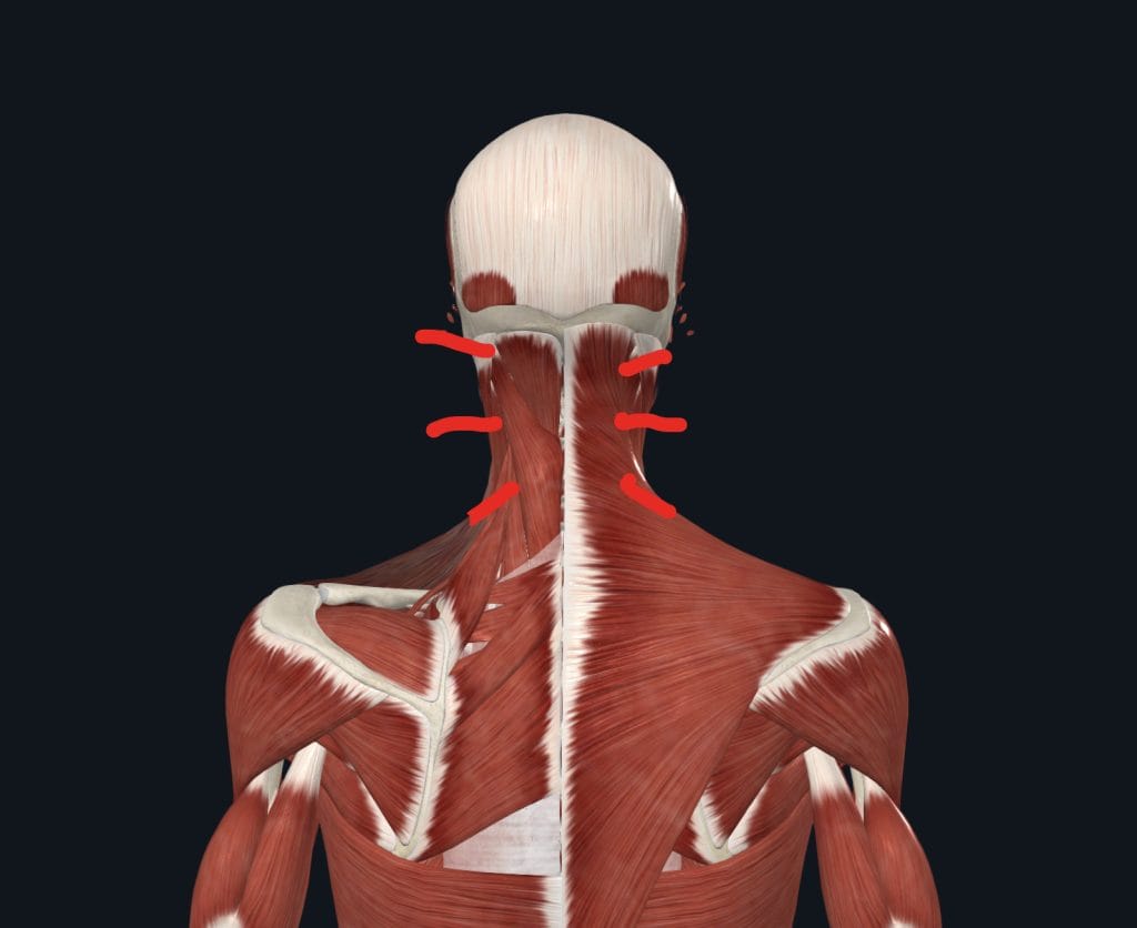 Facteurs qui favorisent les douleurs cervicales