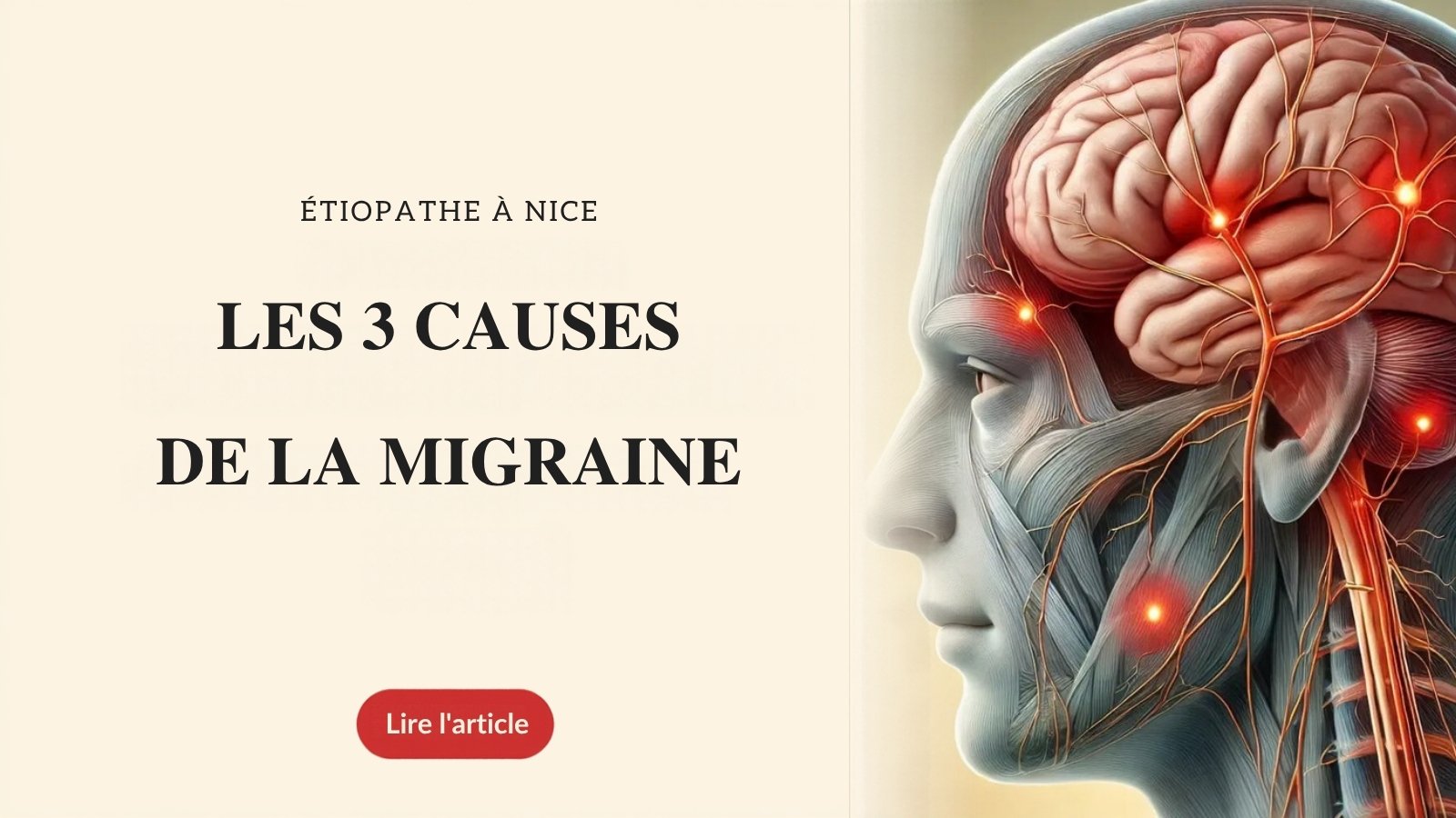 Migraine : comprendre les causes des crises, par un étiopathe à Nice